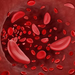 anemia-sintomas