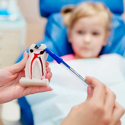 importancia de los sellantes dentales en niños