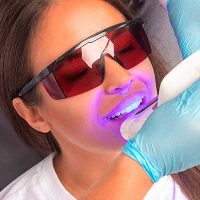 Mitos sobre el blanqueamiento dental